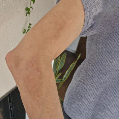 liv_arm_verletzung scenar